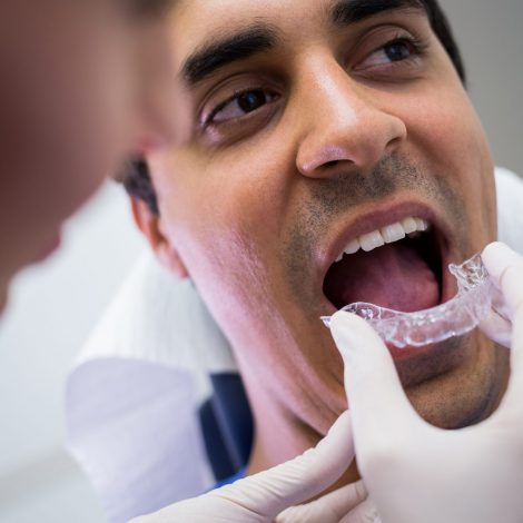 Ortodoncia Invisible en Clínica Dental Roca Siurana de Vilassar de Mar y Badalona